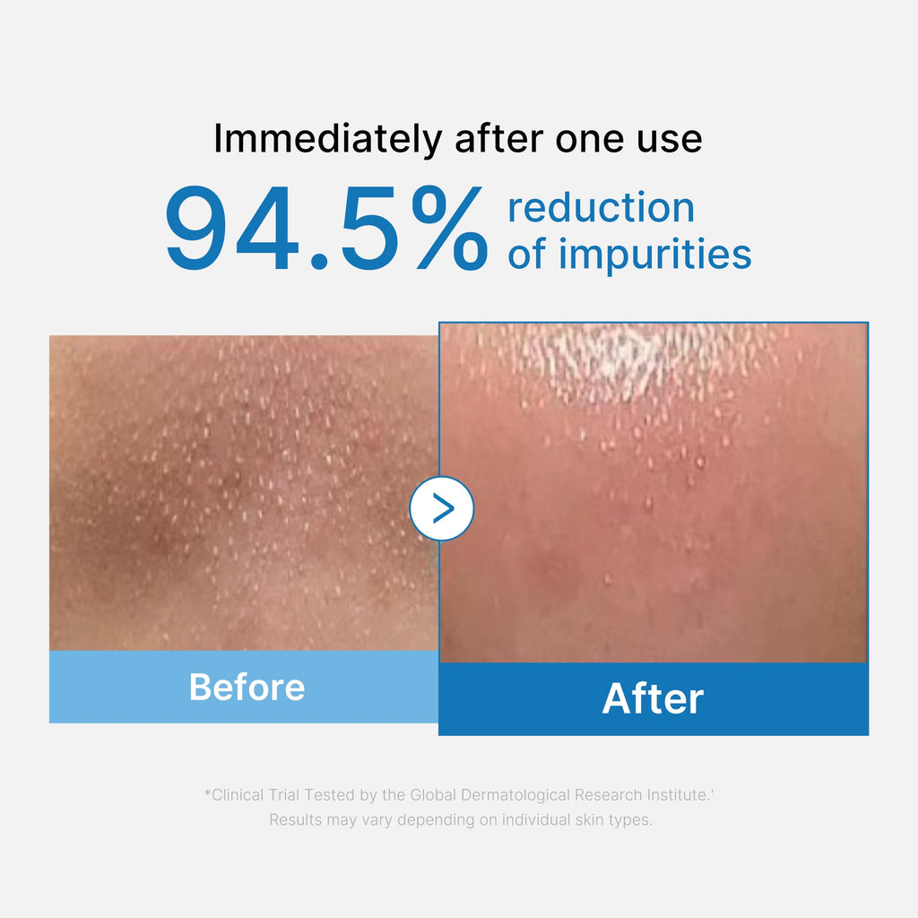 Zero Pore Blackhead Deep Cleansing Oil U0