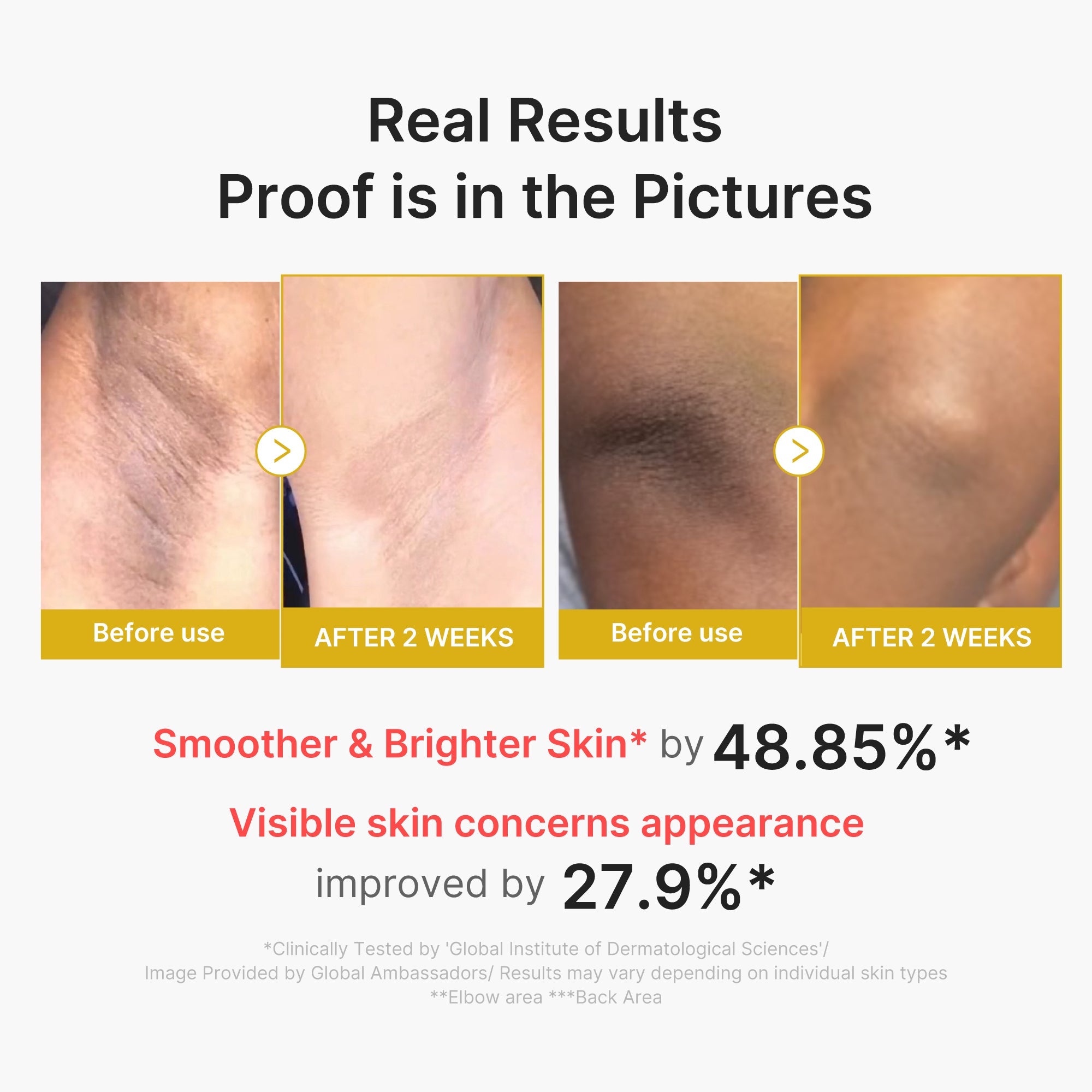 Kojic Acid Turmeric Body Peel Shot T1