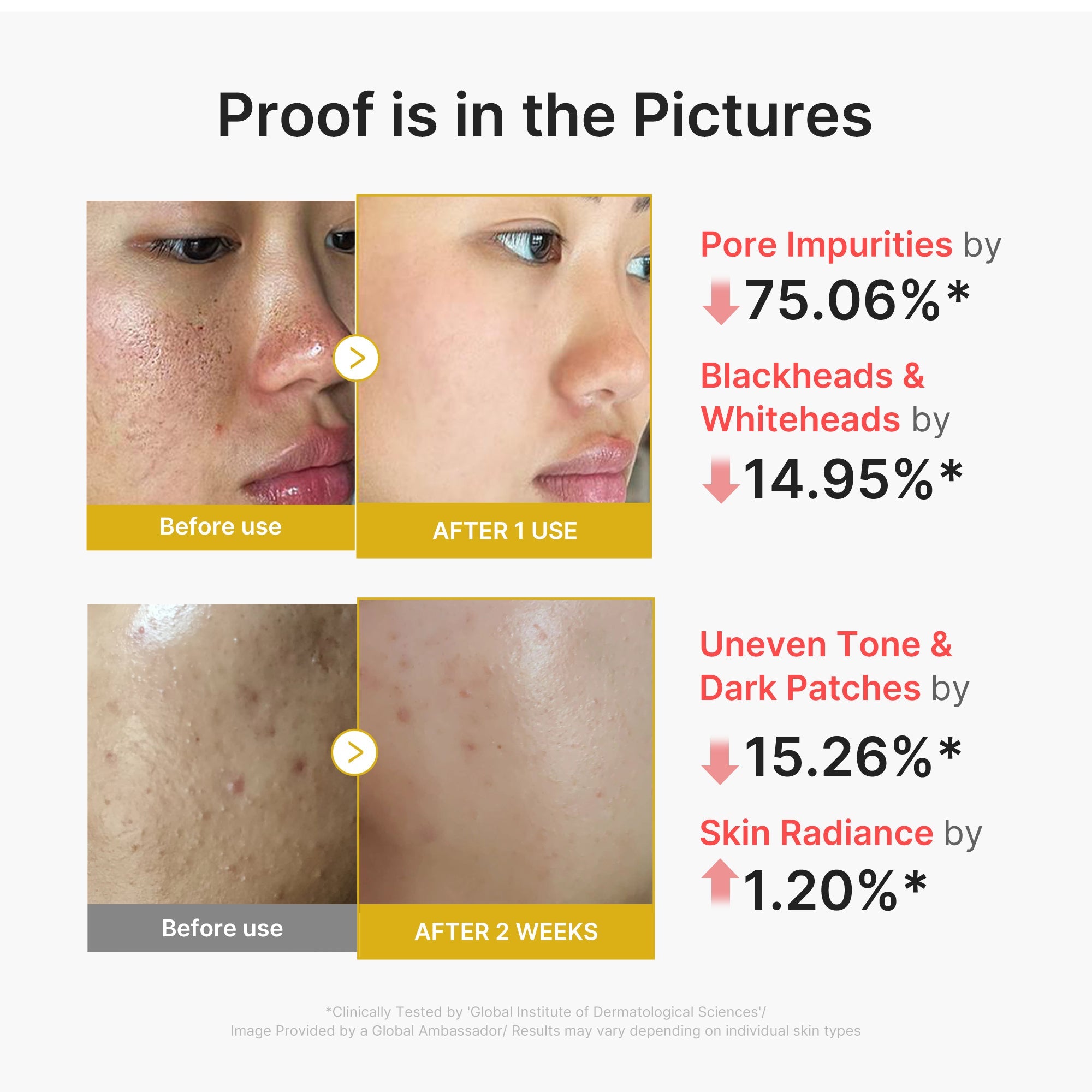 Kojic Acid Turmeric Peel Shot I0