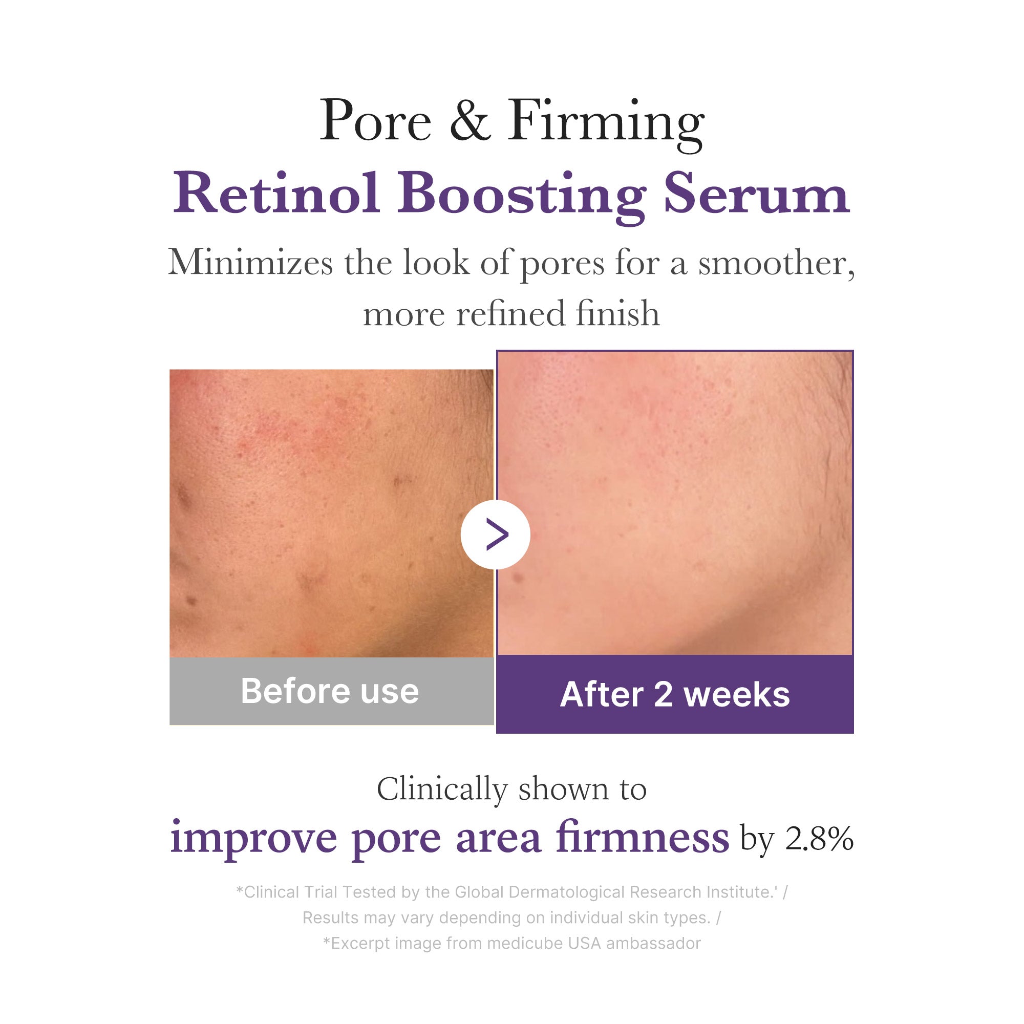 Retinol NMN Boosting Serum K0