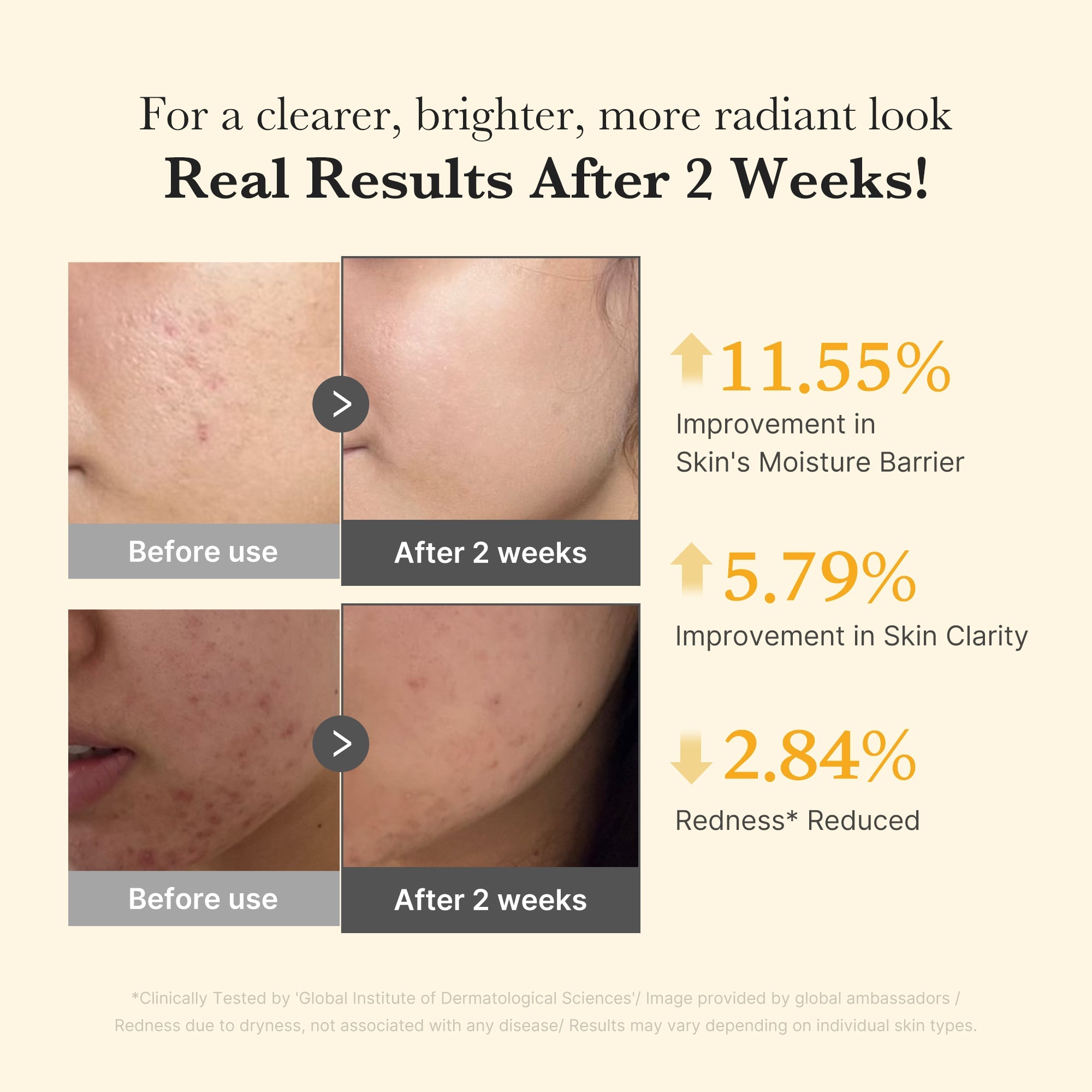 Kojic Acid Turmeric Capsule Serum B0