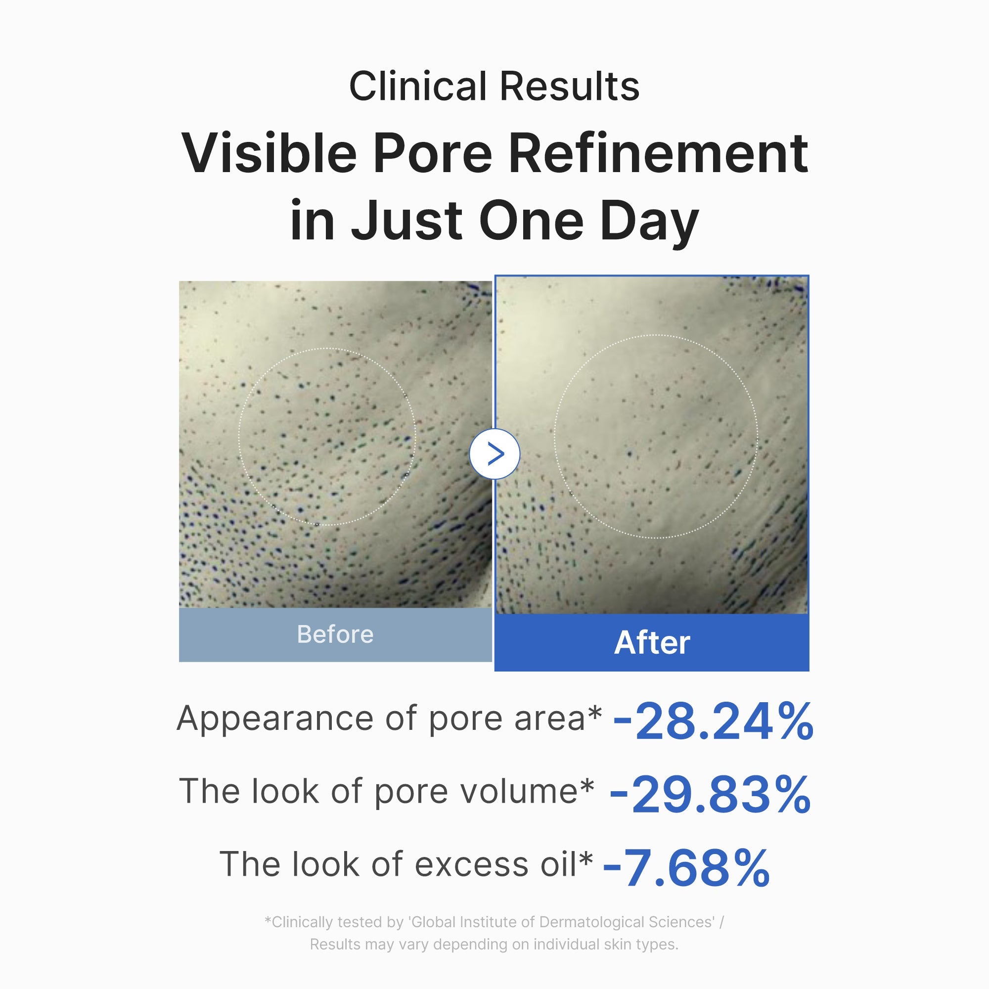 Zero Pore One-day Peptide Serum V9