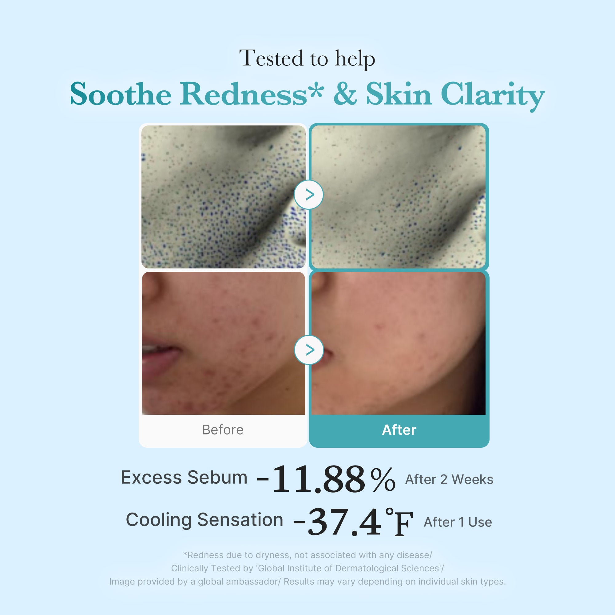 Azelaic Acid Niacinamide Clarifying Toner H3