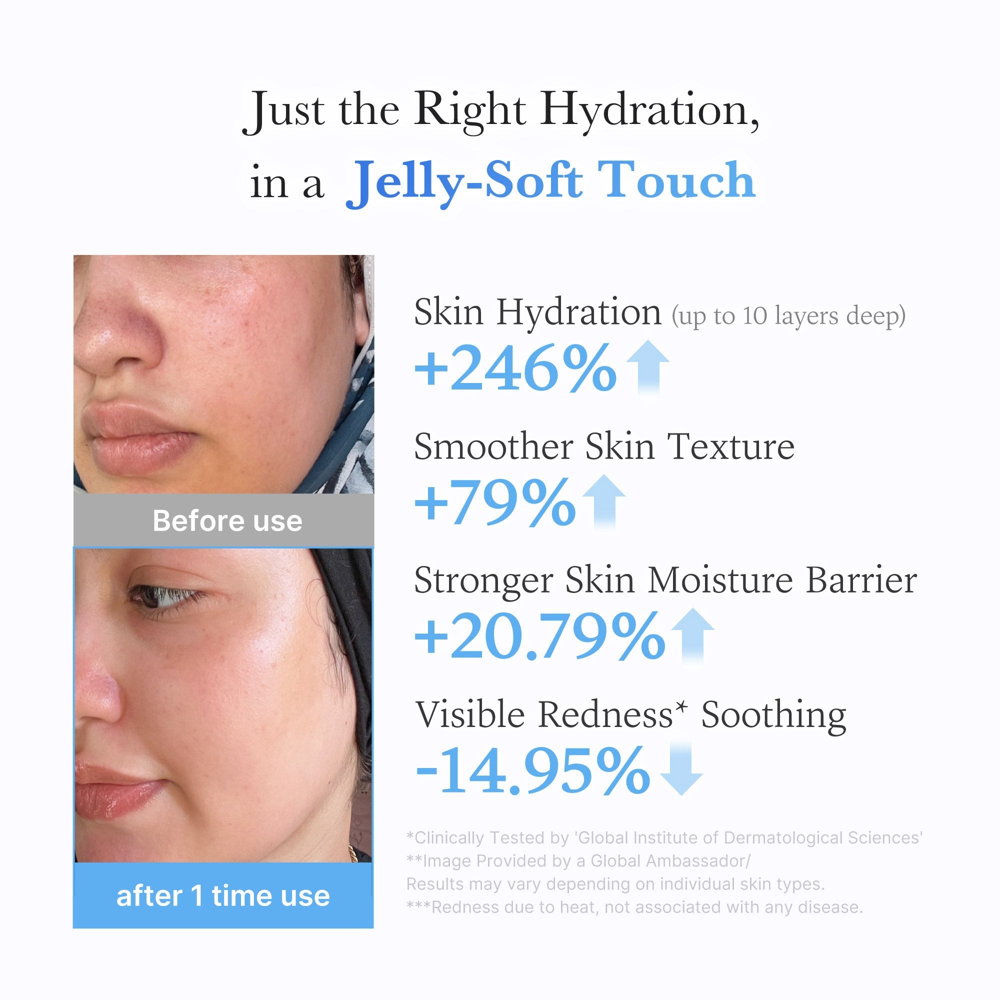 Hyaluronic Ceramide Moisturizing Jelly Cream J5