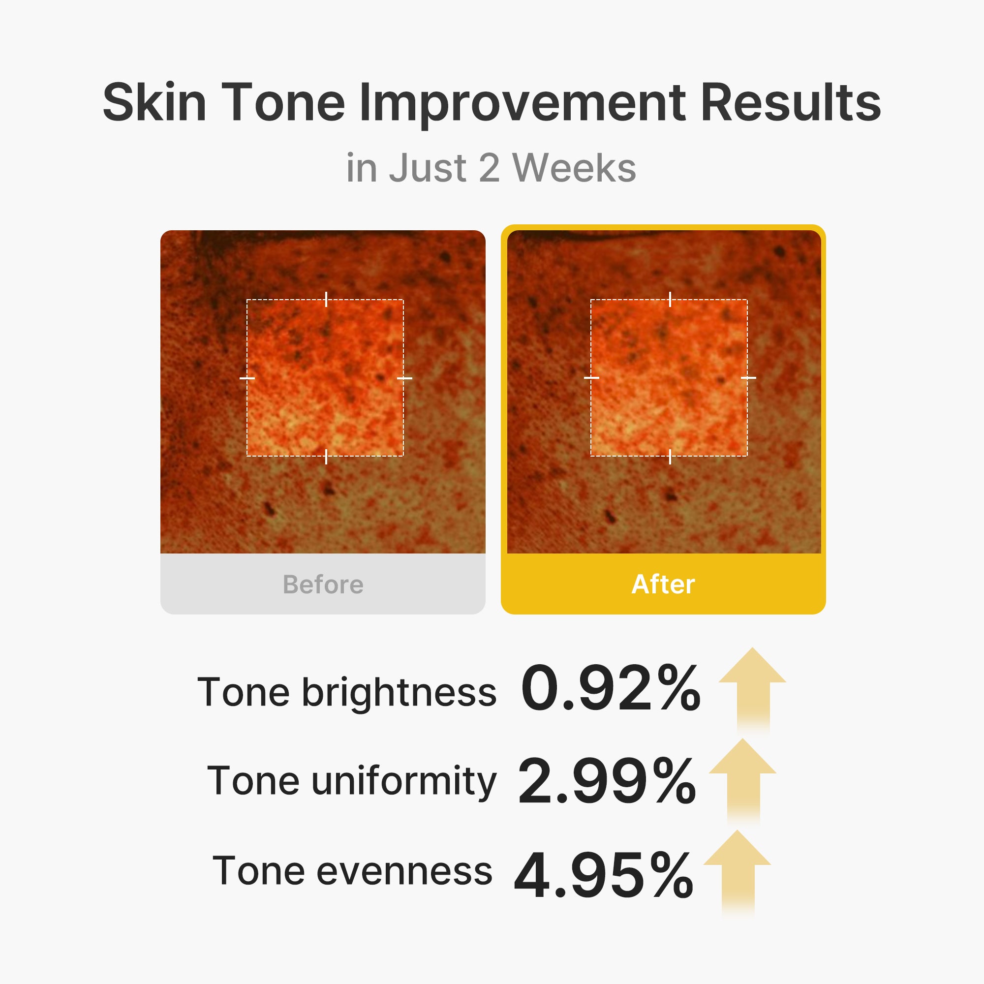 Kojic Acid Turmeric Vita Capsule Cream D7