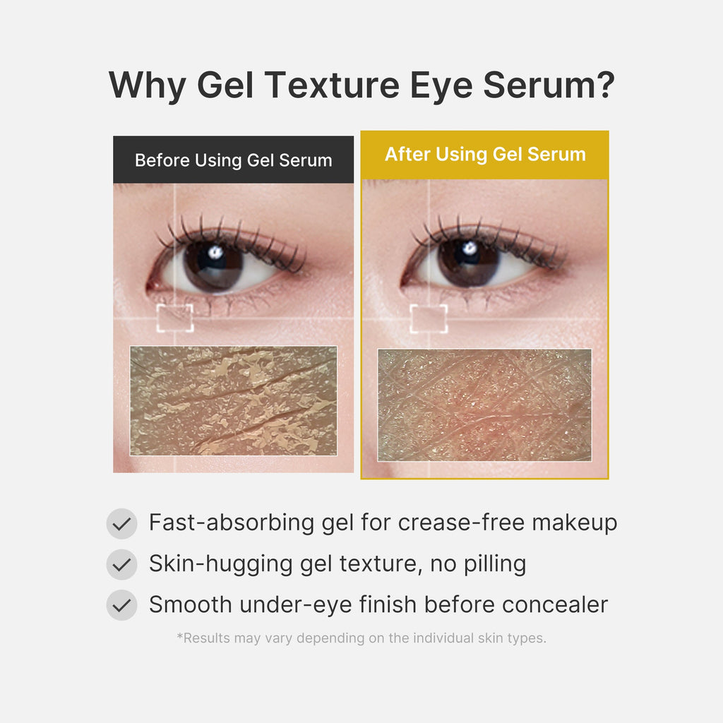 Kojic Acid Tumeric Eye Gel Serum O7