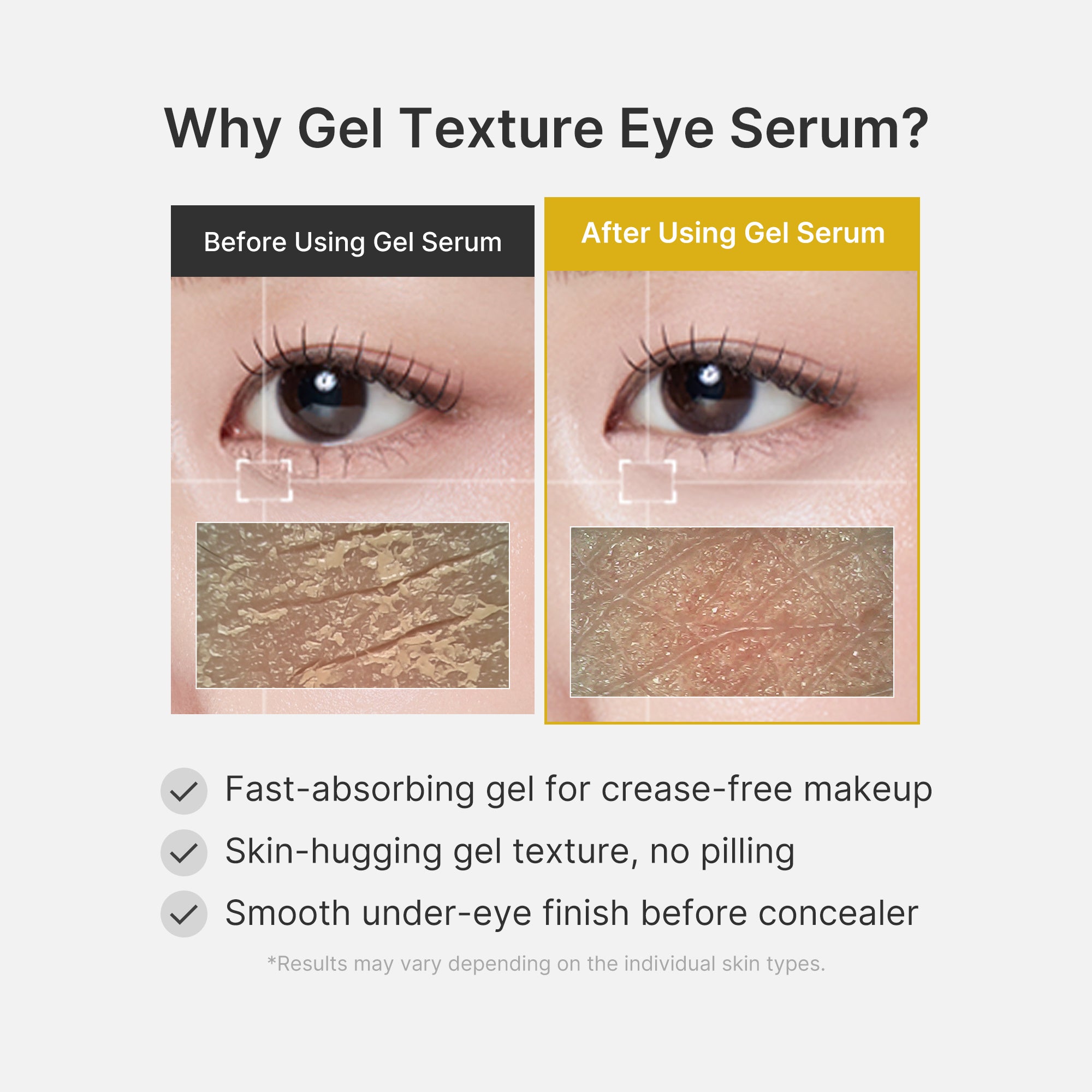 Kojic Acid Tumeric Eye Gel Serum O7