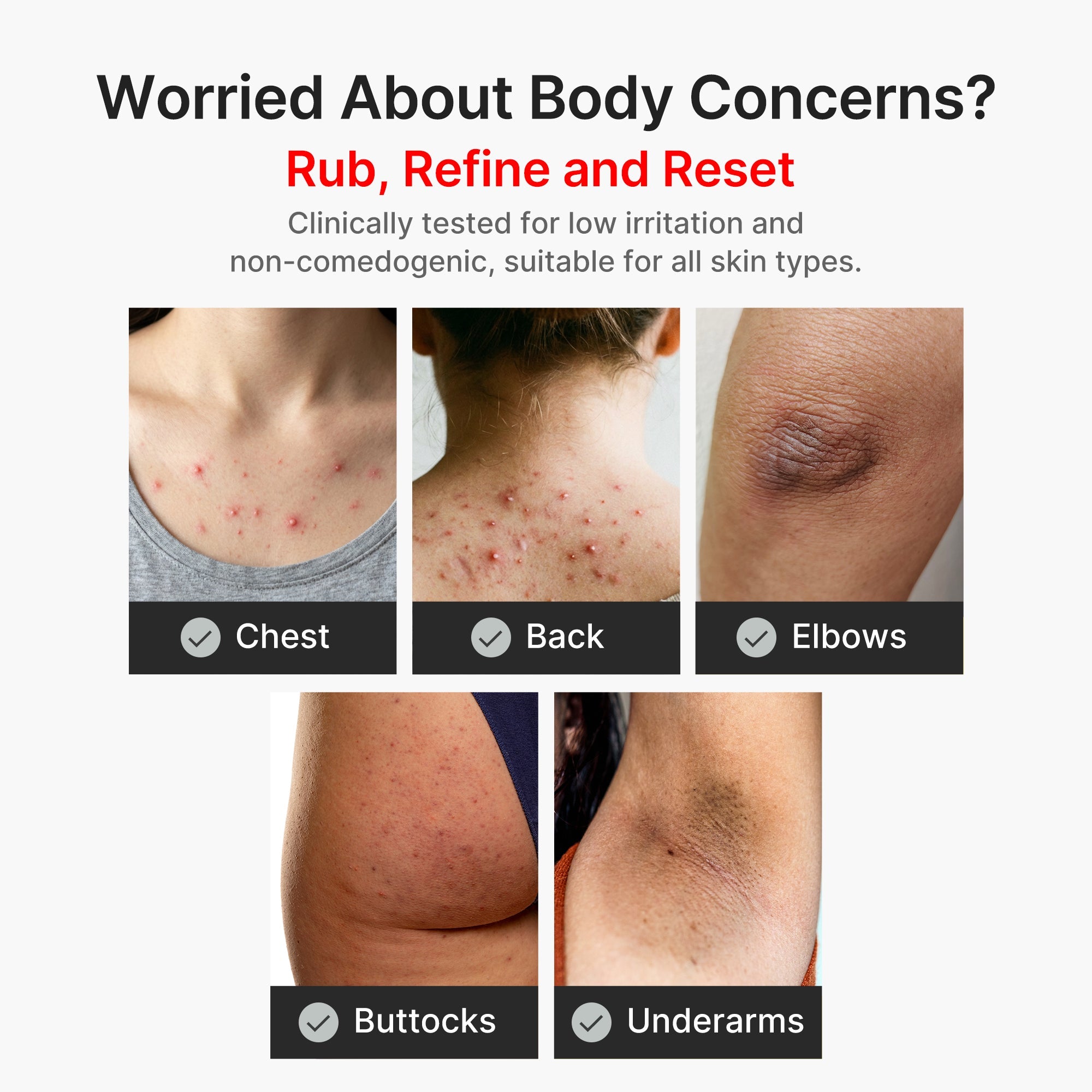 Kojic Acid Turmeric Body Peel Shot C8