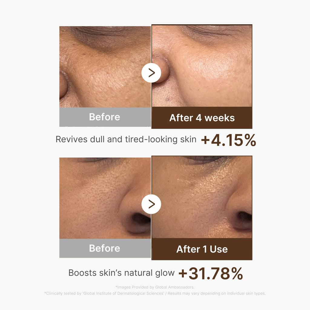 Deep Vitamin C Capsule Serum Q0