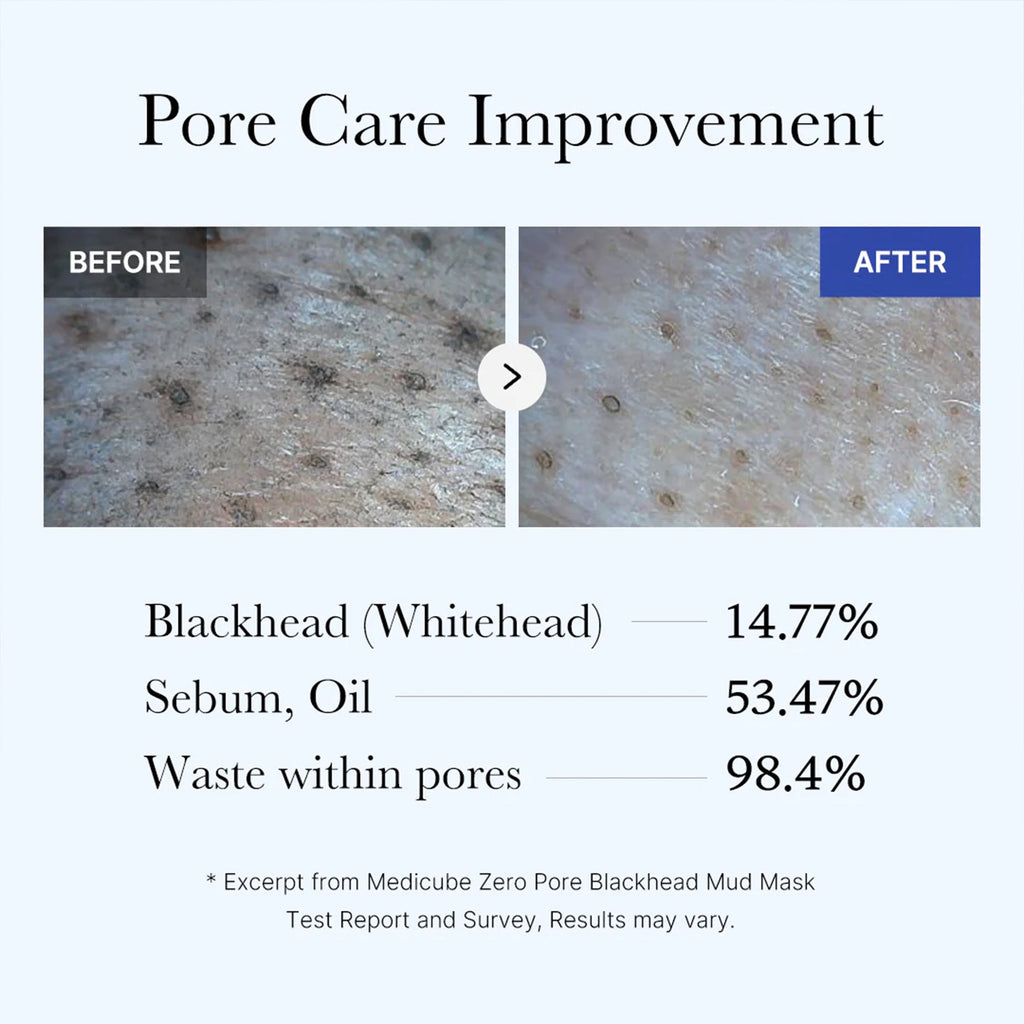 Zero Pore Blackhead Mud Mask C7