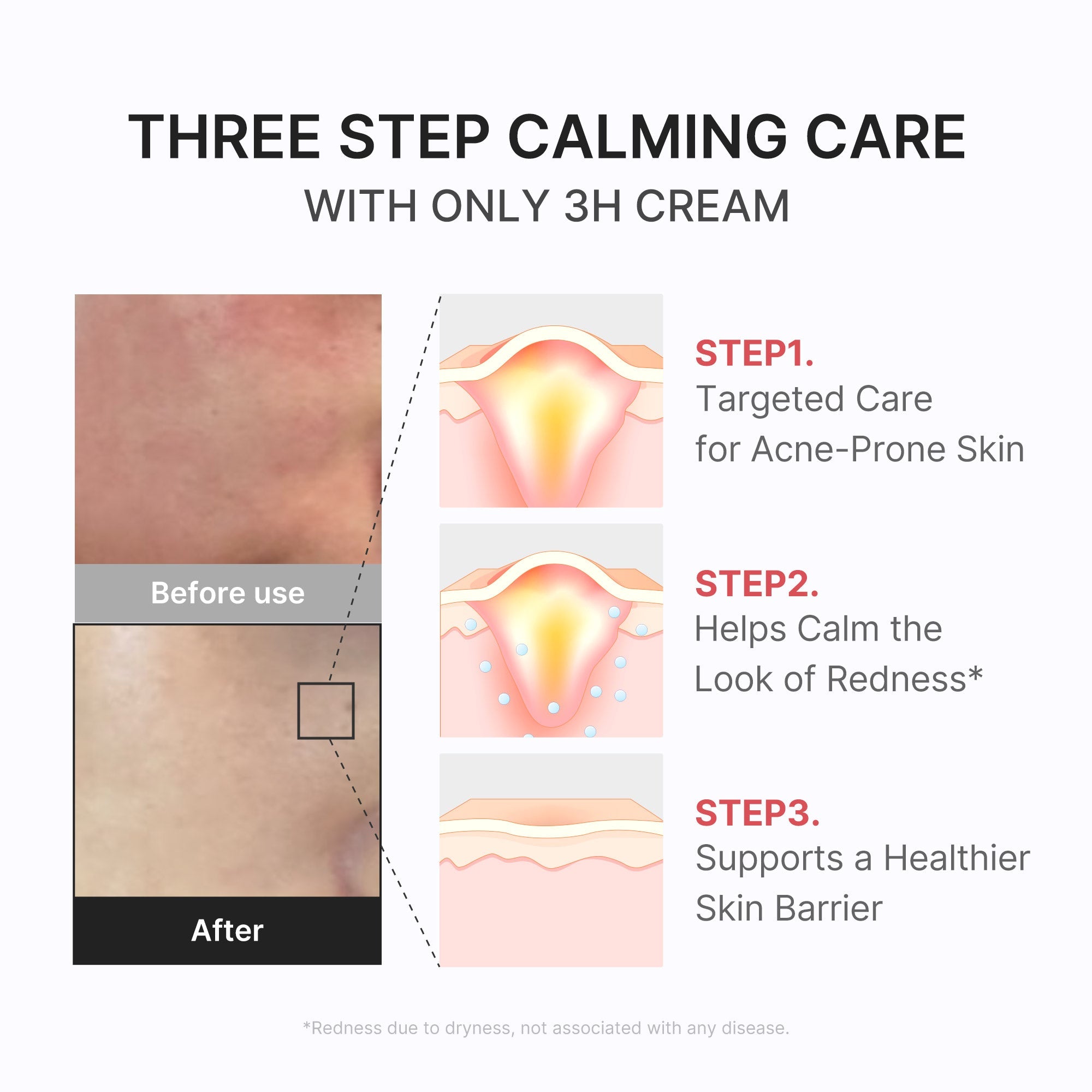 3H Daily Relief Cream H4
