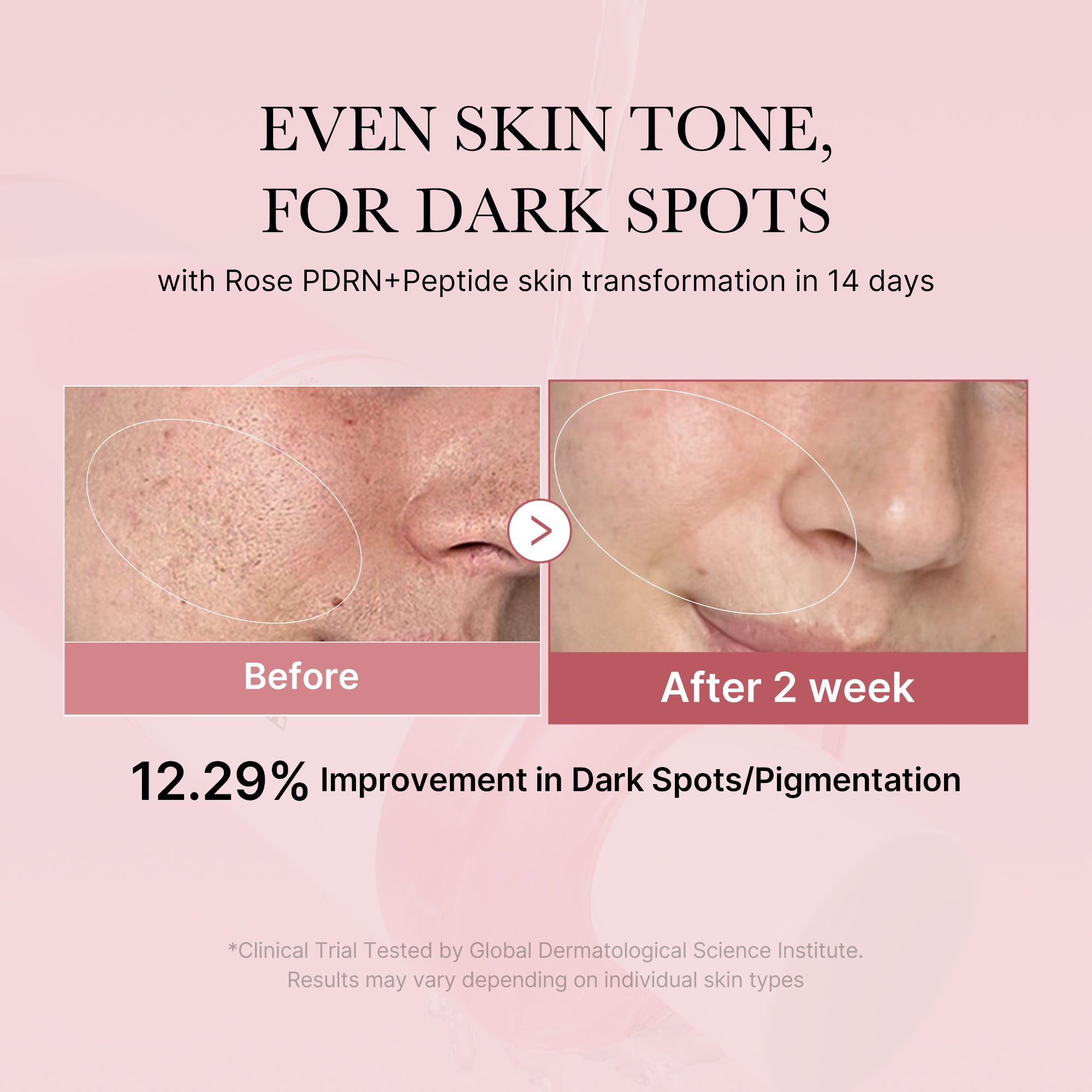 PDRN Pink Peptide Toner T3