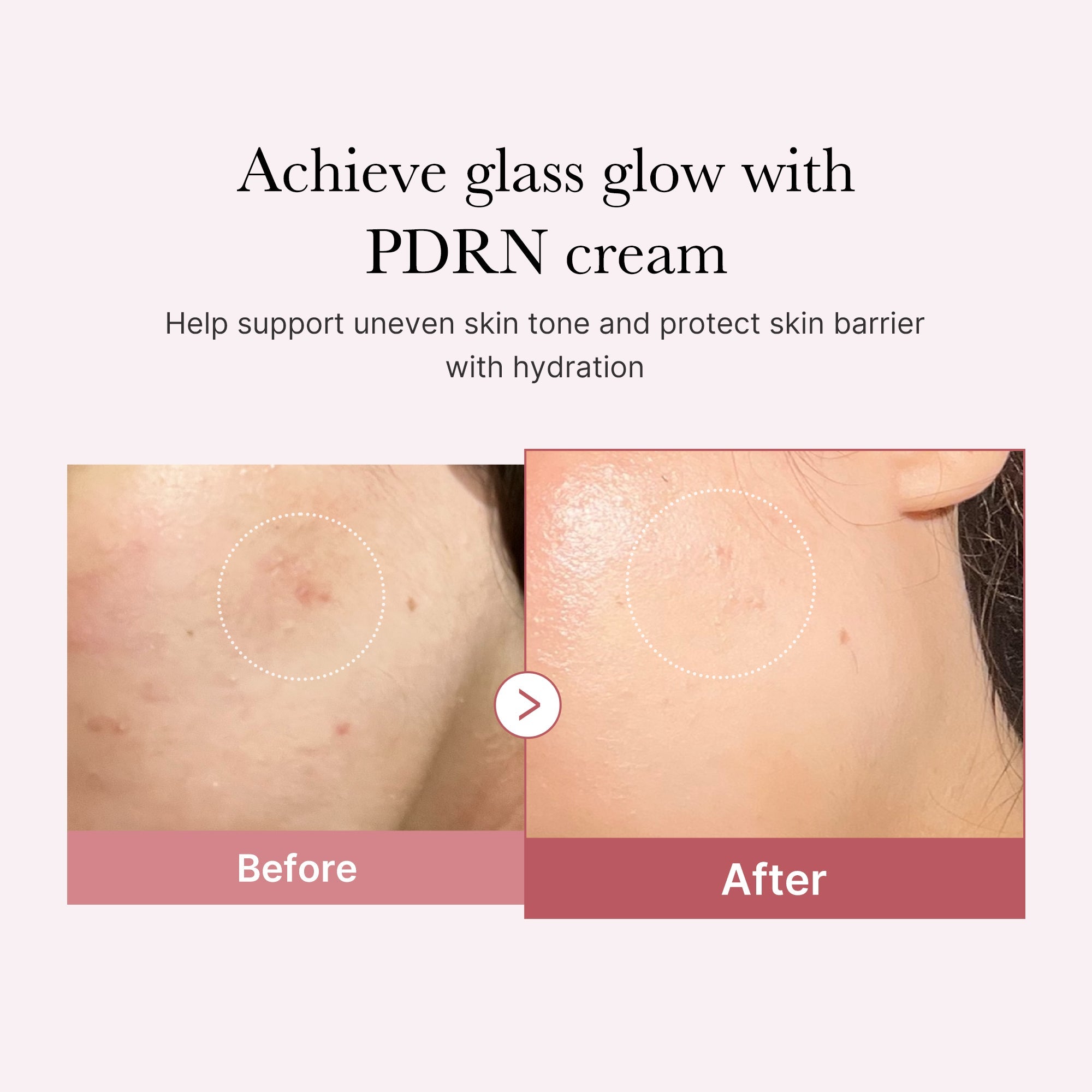 PDRN Pink Peptide Cream Z8