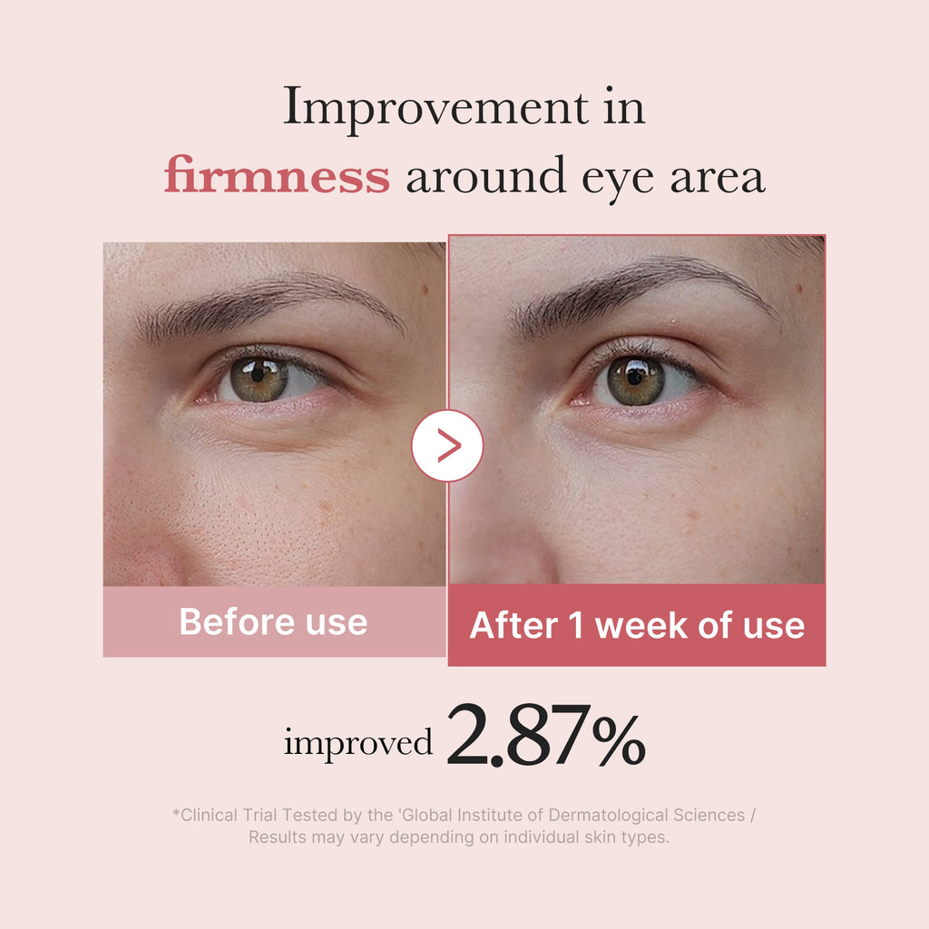 PDRN Pink Peptide Eye Cream V6
