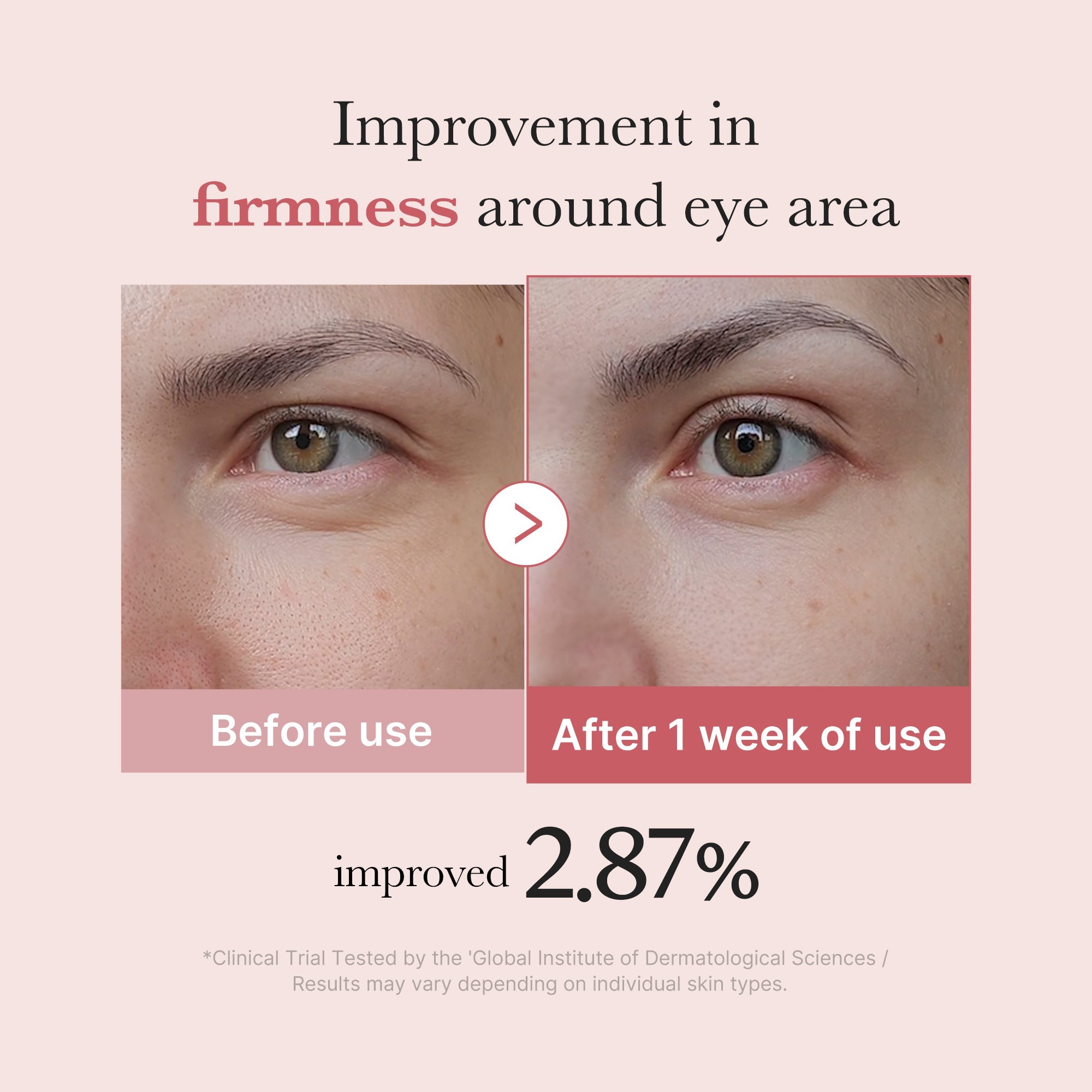 PDRN Pink Peptide Eye Cream V6