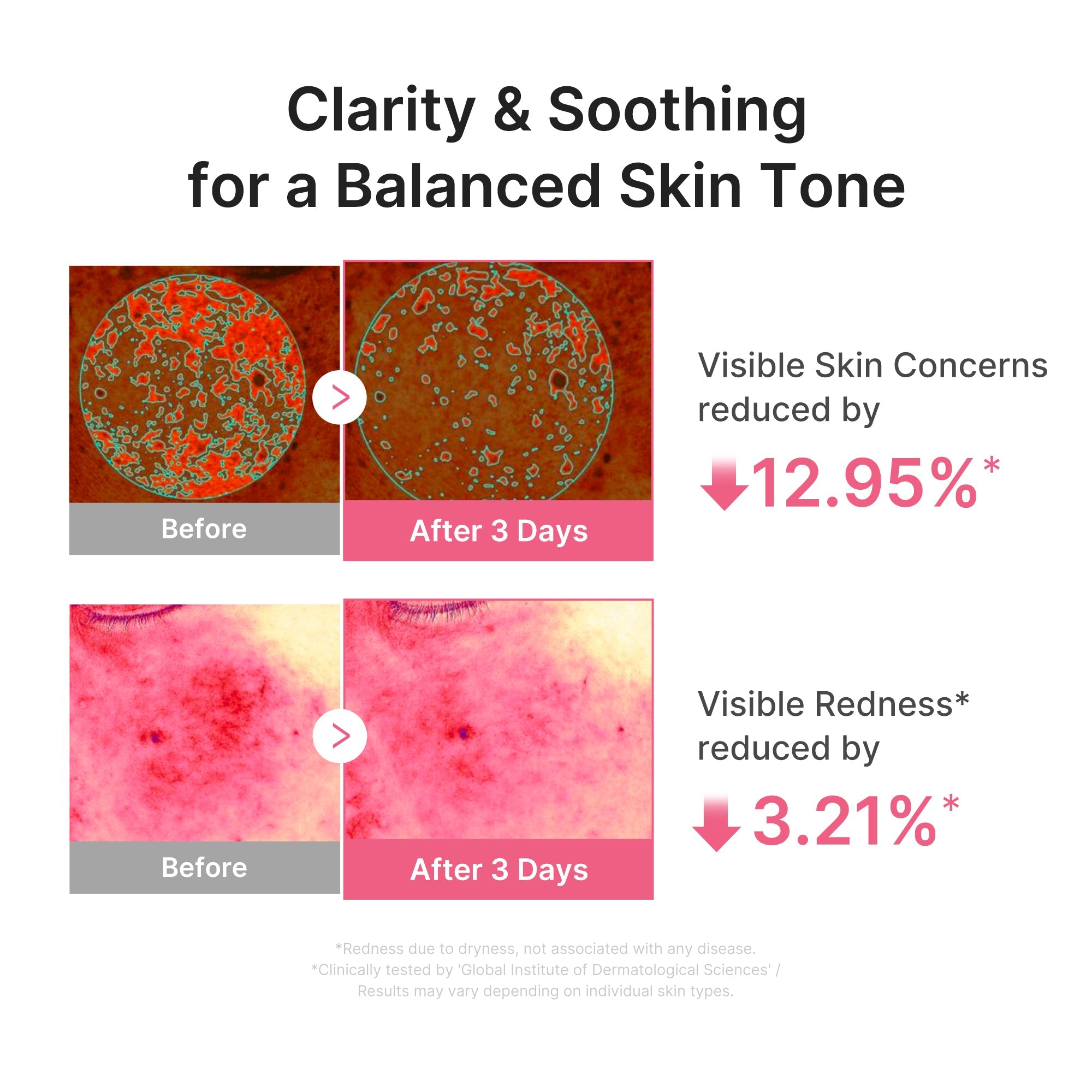Ultra Light PDRN Pink Peptide Serum F4