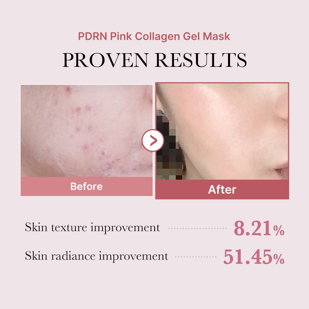 Salmon PDRN Pink Collagen Jelly Gel Mask L9