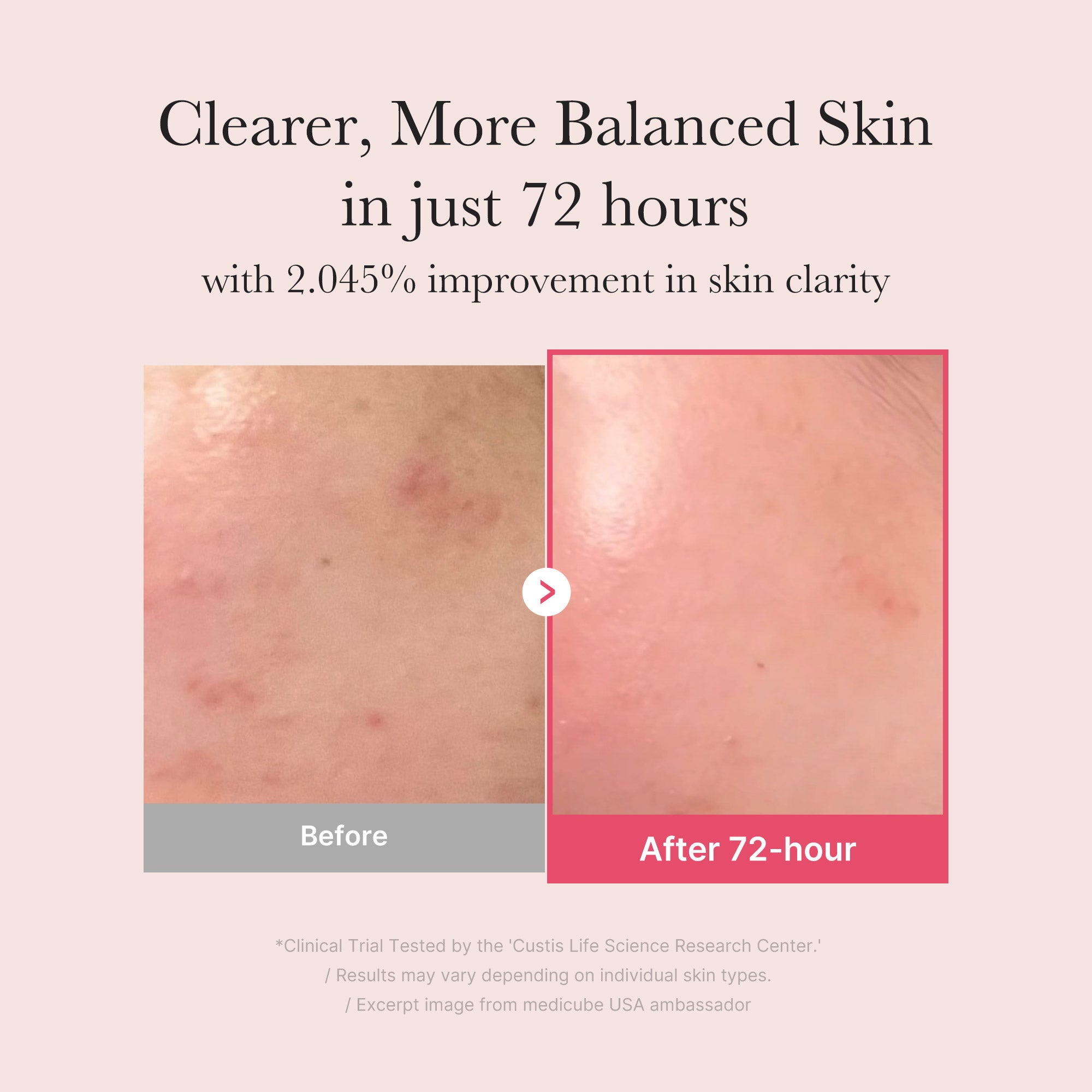 TXA Niacinamide Serum S6