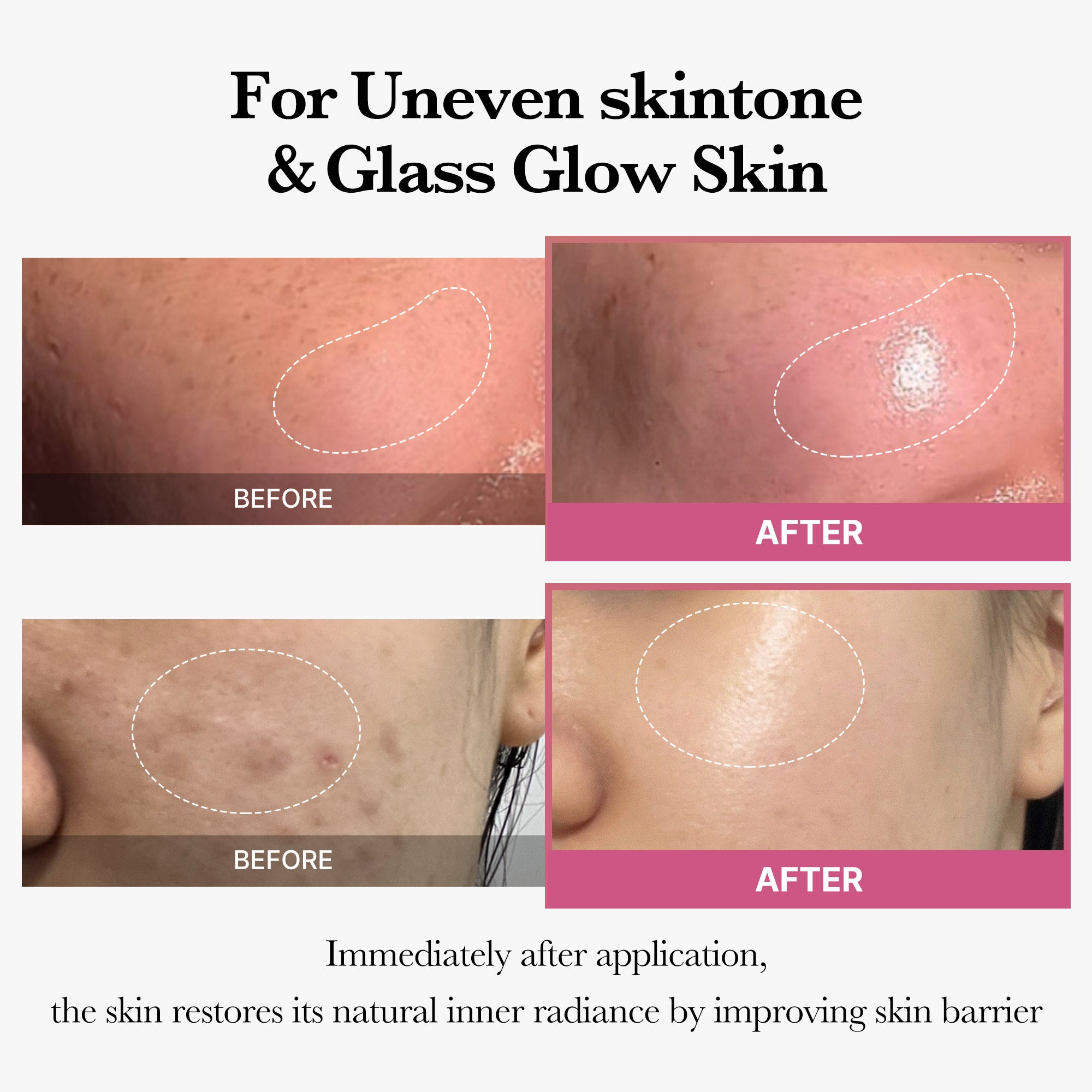 [Tati's Exclusive] Plump Perfection Set X4